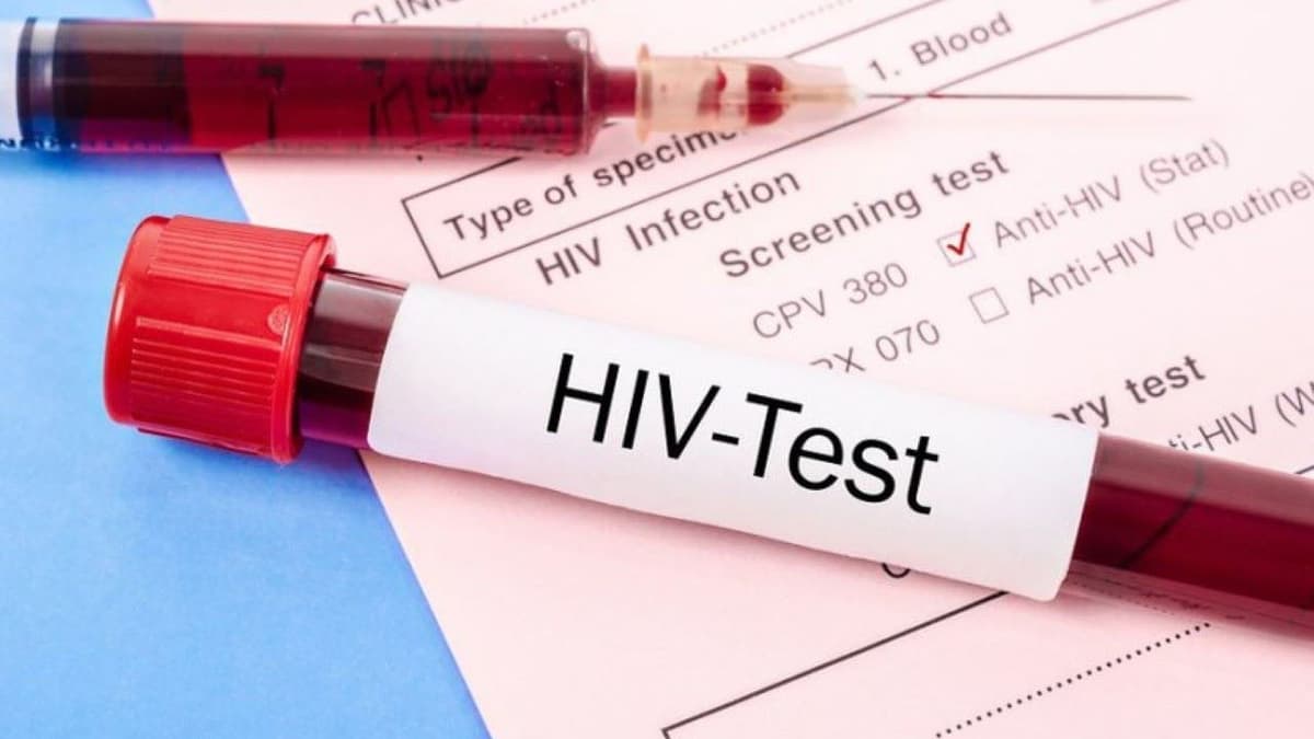 Gợi ý địa chỉ khám HIV/AIDS tại Linh Đàm uy tín, bảo mật