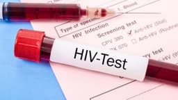 Gợi ý địa chỉ khám HIV/AIDS tại Linh Đàm uy tín, bảo mật