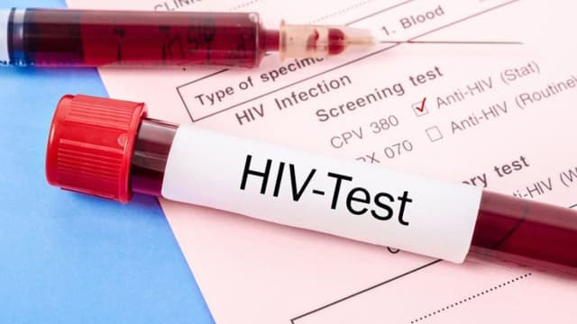 Gợi ý địa chỉ khám HIV/AIDS tại Linh Đàm uy tín, bảo mật