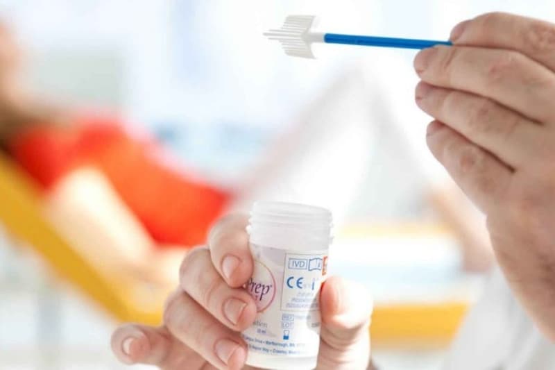 Xét nghiệm Thinprep bao lâu 1 lần? 