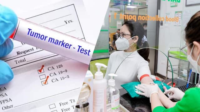 Các marker ung thư nữ – Giải thích chi tiết