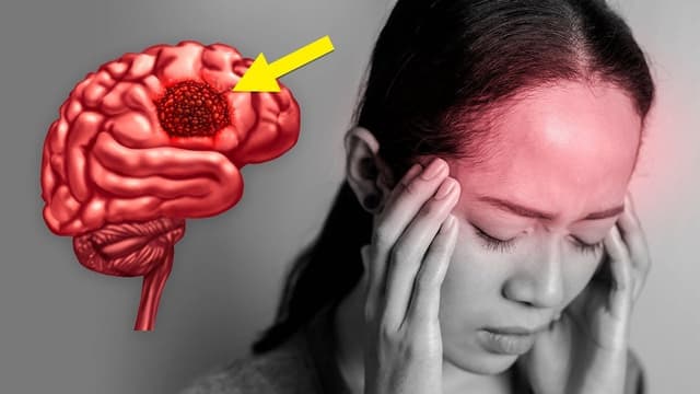 Mổ u não ác tính/lành tính sống được bao lâu?