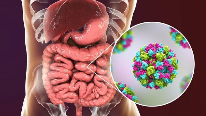 Điều trị rối loạn tiêu hóa như thế nào? Khi nào cần kháng sinh?