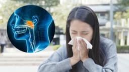 Sàng lọc ung thư vòm họng thế nào? Tìm hiểu chi tiết