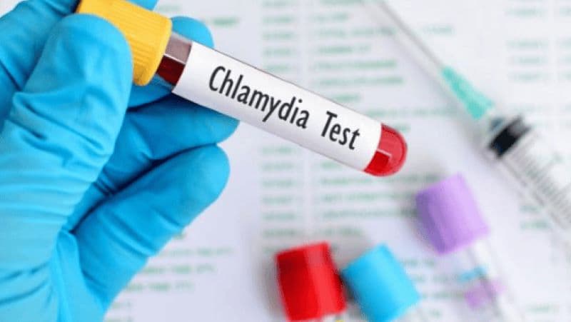 Nên xét nghiệm Chlamydia ở Đại Từ tại đâu có kết quả nhanh?