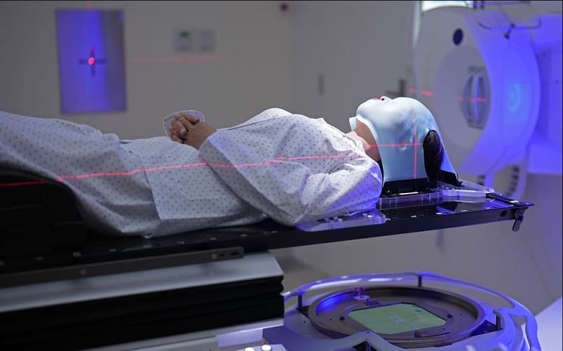 xạ trị u não ác tính sống được bao lâu
