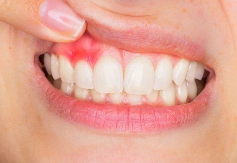 u lợi có nguy hiểm không