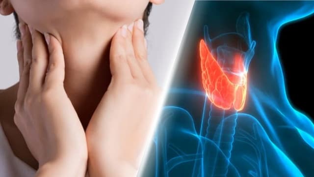 U nang tuyến giáp có tự tiêu không?