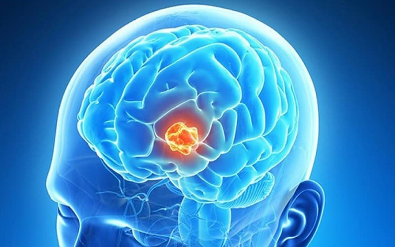 u não ác tính có chữa được không