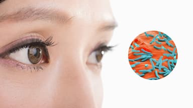 Uống thuốc lao bị mờ mắt phải làm sao?