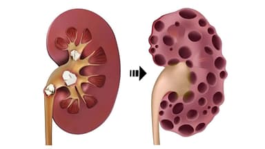 Uống thuốc nhiều có gây suy thận không? 