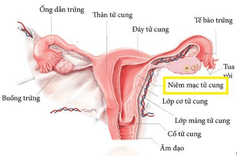 Viêm nội mạc cổ tử cung là gì? Nguyên nhân, triệu chứng