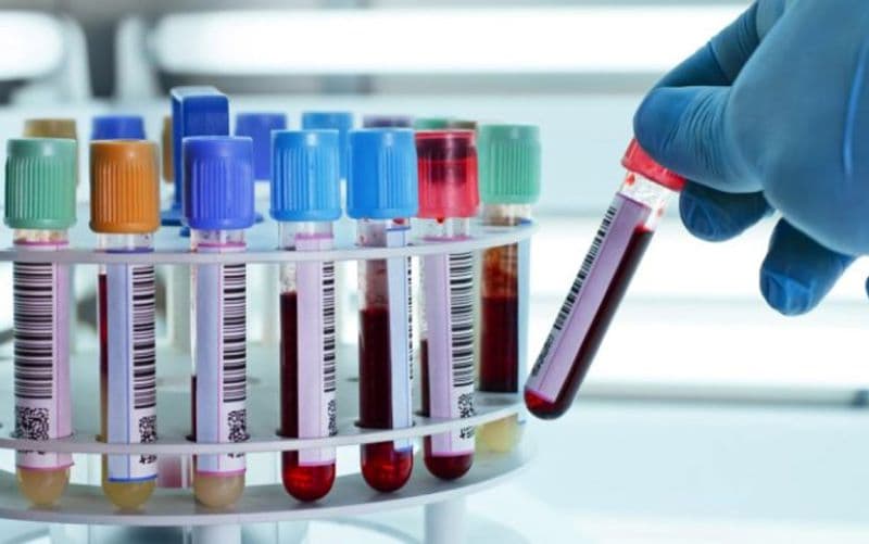Nên xét nghiệm Chlamydia ở đâu tại Linh Đàm?