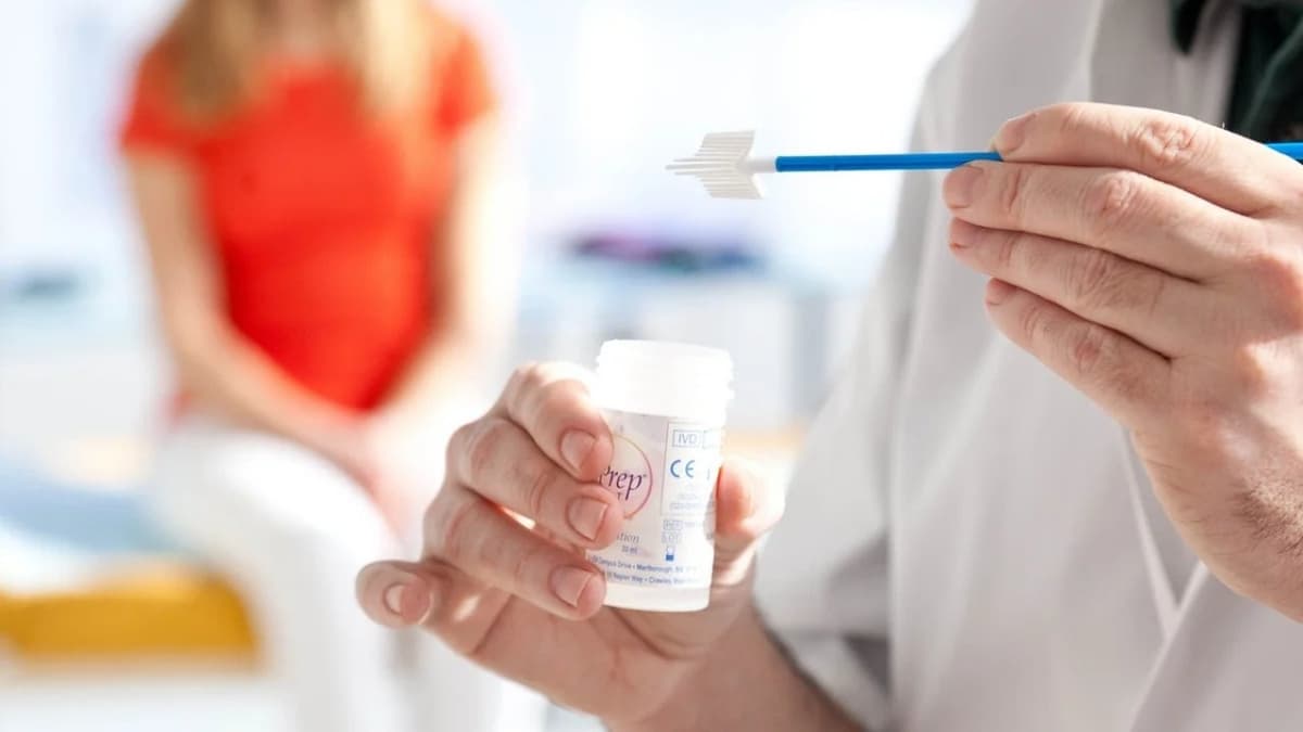 Xét nghiệm Thinprep bao lâu 1 lần? 