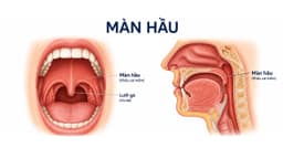 Màn hầu nằm ở đâu? Vị trí, chức năng và các vấn đề sức khỏe liên quan