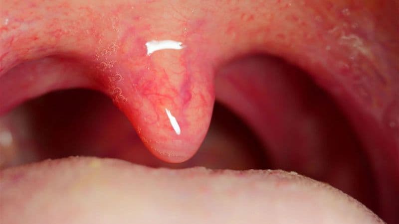Lưỡi gà có tác dụng gì