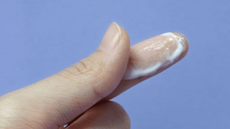 Nấm Candida phụ khoa thường gây ngứa rát vùng kín, khí hư trắng vón cục như bã đậu và có thể kèm sưng tấy âm hộ. 