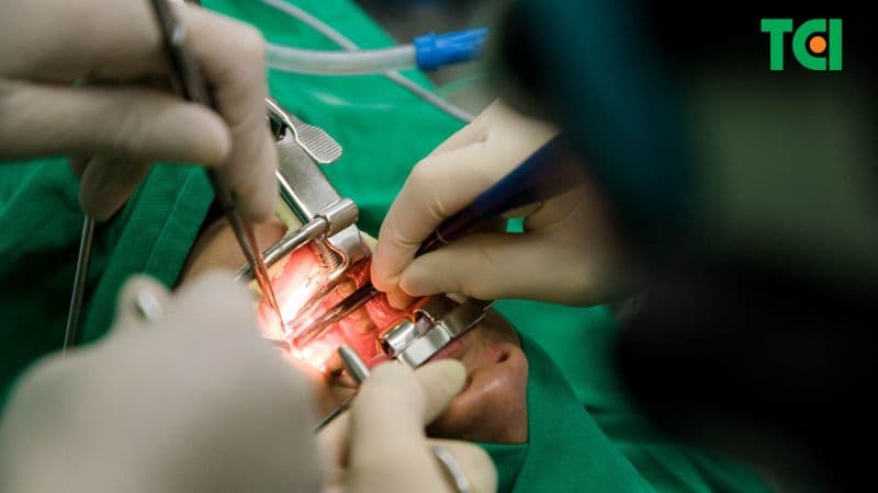Màn hầu nằm ở đâu