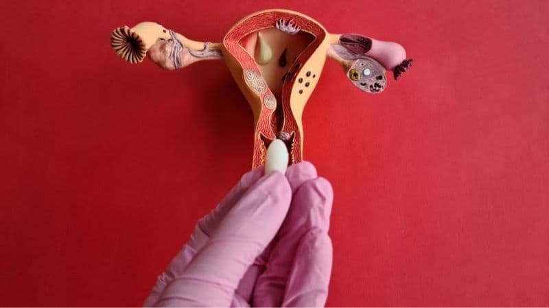 Thuốc trị nấm có thể được sử dụng theo đường uống hoặc dạng đặt tại chỗ, tùy tình trạng và chỉ định của bác sĩ. 