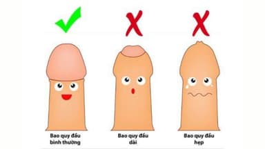 Cắt bao quy đầu gây mê: Quy trình, chi phí và lưu ý chăm sóc