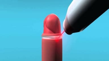 Cắt bao quy đầu uy tín: Tiêu chí lựa chọn địa chỉ an toàn, phù hợp