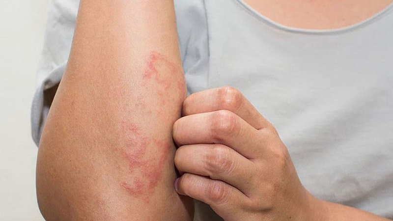 Những trường hợp nên đi khám bác sĩ chuyên khoa da liễu sớm để được điều trị