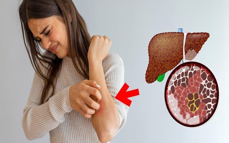 Nhận biết sớm các dấu hiệu bất thường giúp phát hiện và điều trị bệnh gan mật kịp thời