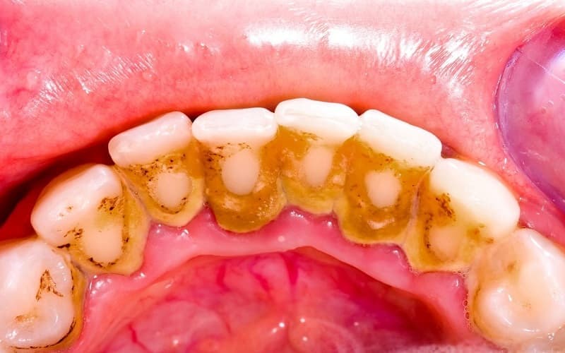 Bệnh lý răng hàm mặt có thể biểu hiện qua nhiều dấu hiệu bất thường ở răng, nướu và vùng hàm mặt. 