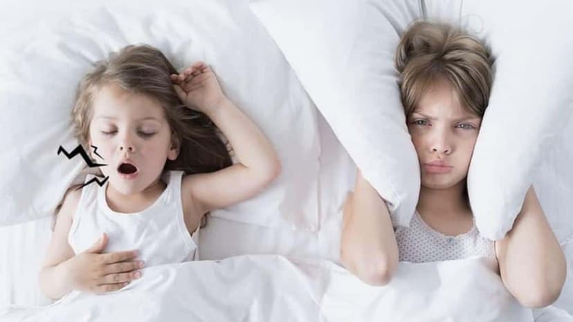 Nạo VA xong bé vẫn ngủ ngáy: Dấu hiệu cảnh báo rối loạn hô hấp khi ngủ