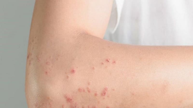 Những vấn đề về da được bác sĩ da liễu thăm khám và điều trị hiệu quả