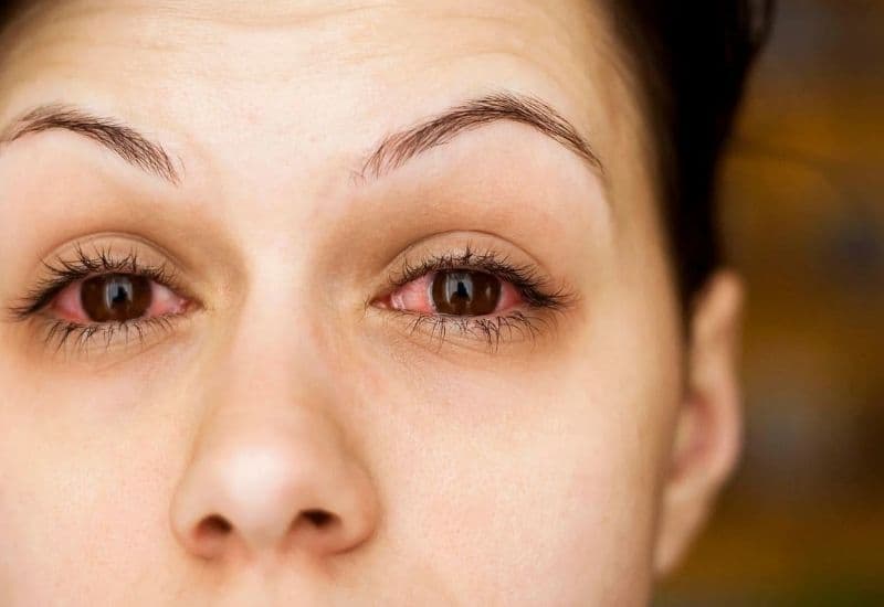 Bệnh nhậm mắt là gì và do nguyên nhân nào?