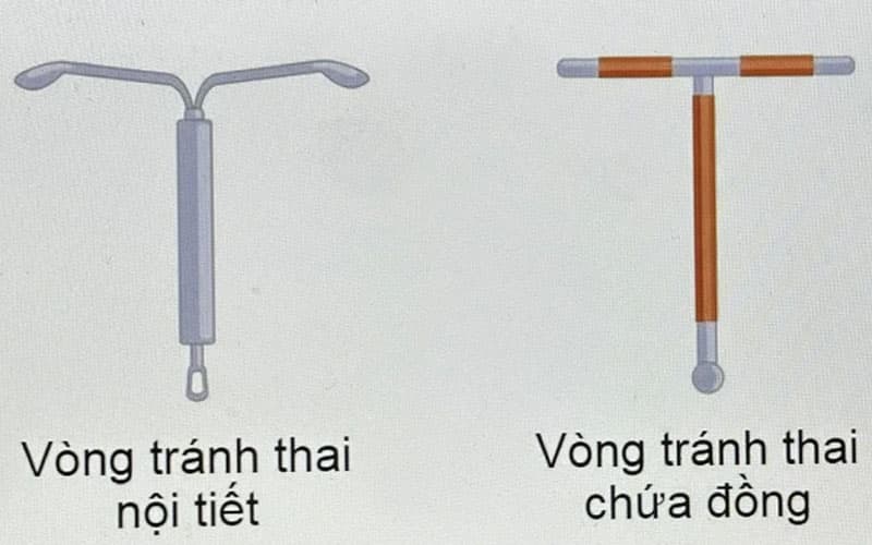 Các loại vòng tránh thai phổ biến