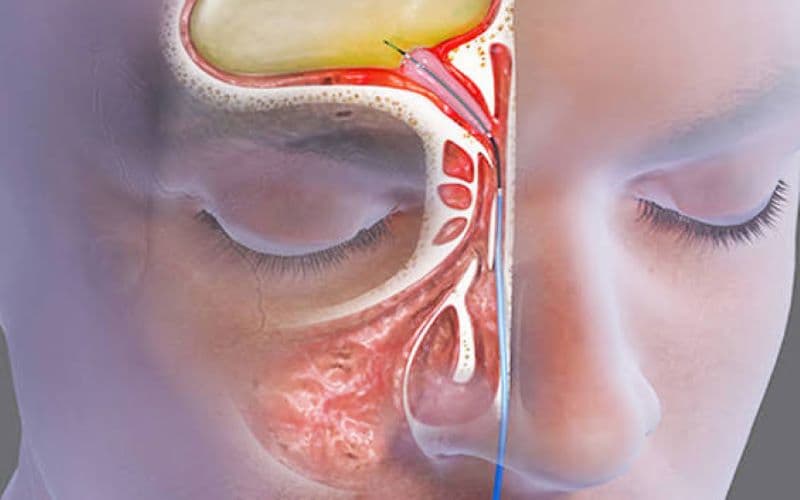 Các vấn đề về tai, mũi và họng là nhóm bệnh lý có thể gặp ở nhiều độ tuổi
