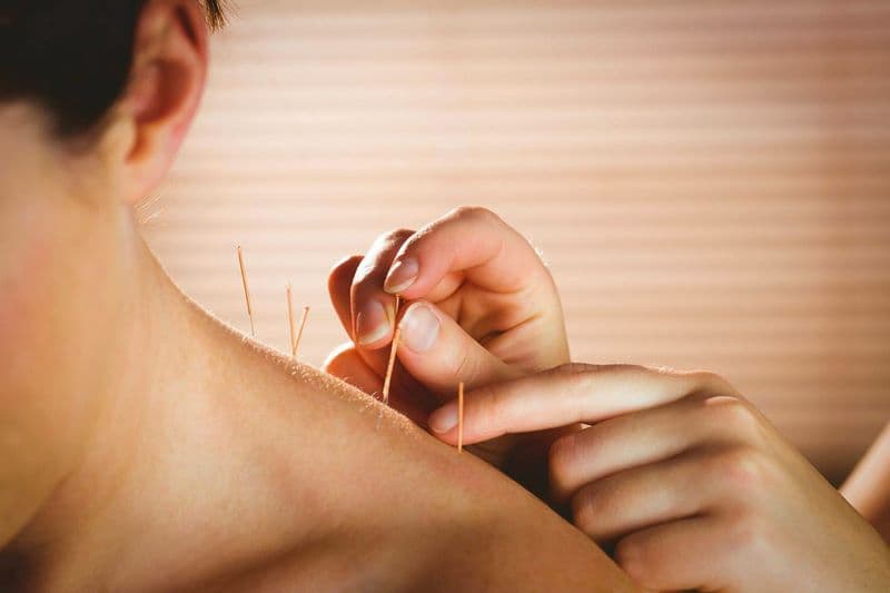 Châm cứu bấm huyệt dựa trên nguyên lý tác động vào các huyệt đạo trên cơ thể để tạo kích thích