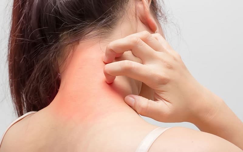 Thuốc dị ứng giúp kiểm soát hiệu quả nhiều triệu chứng khó chịu
