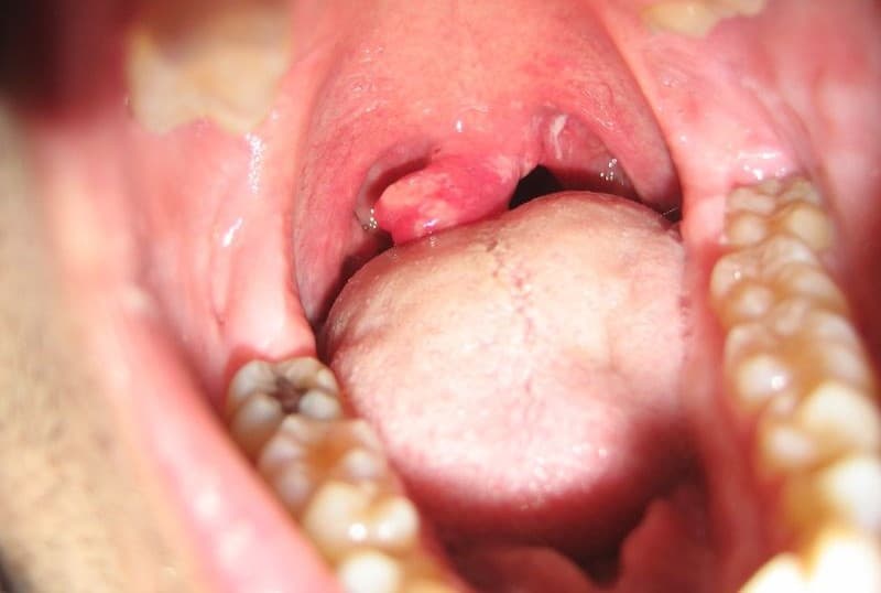 Lưỡi gà nằm giữa khẩu cái mềm, phối hợp bảo vệ đường thở khi ăn uống