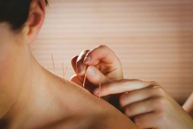 Kim châm cứu có thể tạo ra những thay đổi tại mô xung quanh vị trí được kích thích