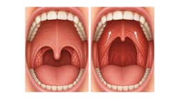 Cơ căng màn hầu: Chức năng, vai trò và các vấn đề sức khỏe liên quan