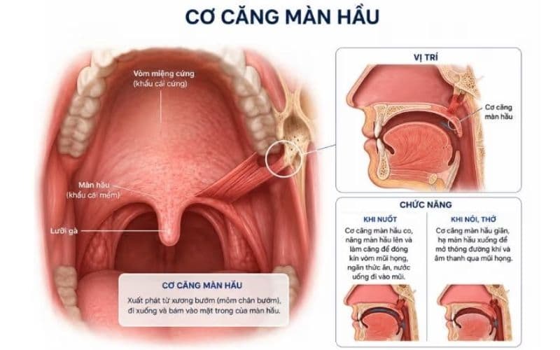 Cơ căng màn hầu