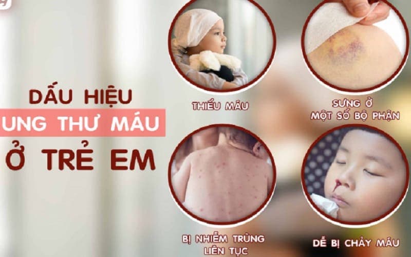 Dấu hiệu ung thư máu ở trẻ em