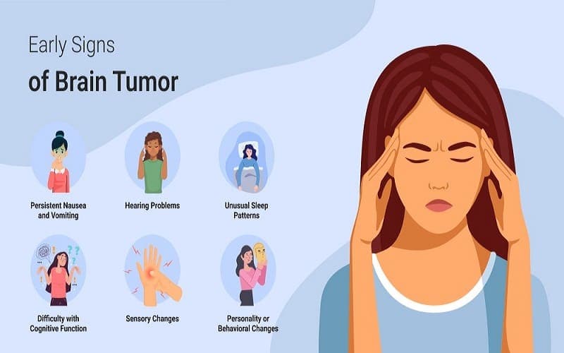Dấu hiệu ung thư não sớm