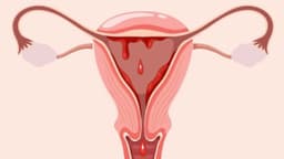 Đến tháng có dễ thụ thai không? Khả năng mang thai ngày đèn đỏ