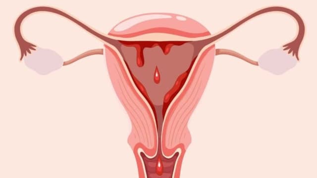 Đến tháng có dễ thụ thai không? Khả năng mang thai ngày đèn đỏ