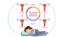 Làm thế nào để đều kinh nguyệt? Nguyên nhân và cách điều kinh