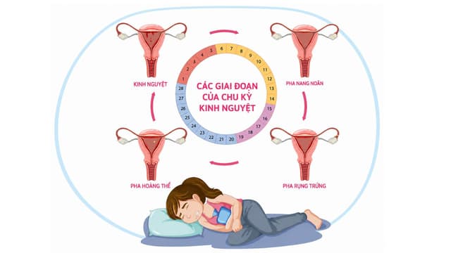 Làm thế nào để đều kinh nguyệt? Nguyên nhân và cách điều kinh
