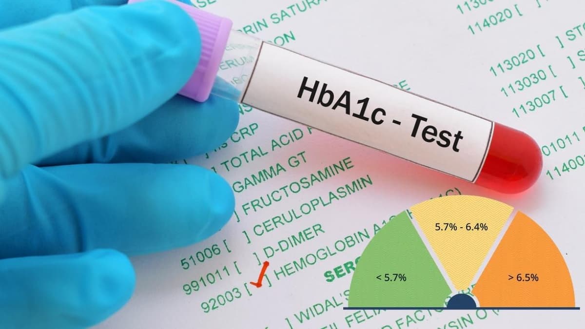 Chỉ số HbA1c là gì và ý nghĩa trong theo dõi bệnh tiểu đường