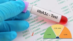 Chỉ số HbA1c là gì và ý nghĩa trong theo dõi bệnh tiểu đường