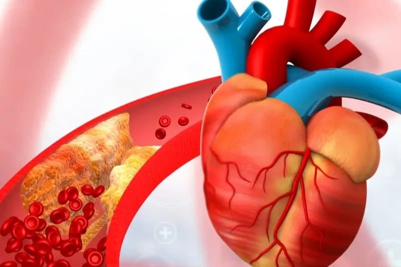 Hẹp động mạch vành có nguy hiểm không