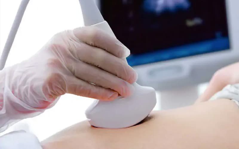 Siêu âm giúp chẩn đoán các bất thường tử cung – buồng trứng