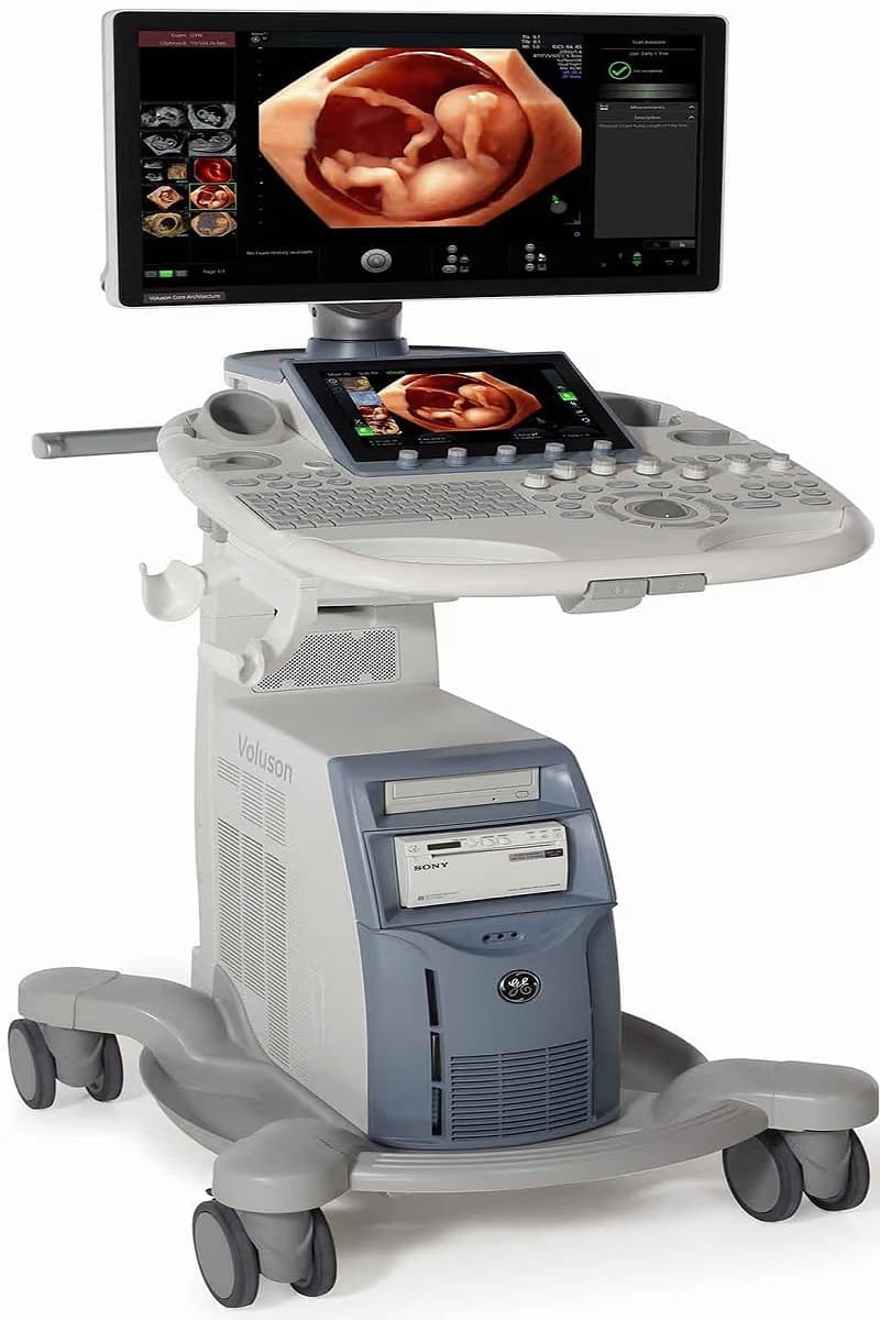 Máy siêu âm Voluson S8/S8t hỗ trợ tạo hình ảnh 3D/4D sắc nét